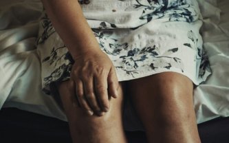 Artritis zglobova: simptomi, uzroci, liječenje i prevencija